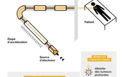 La nouvelle ère de la Radiothérapie